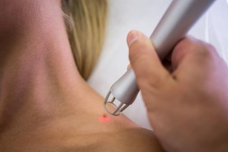 El peligro de tomar el sol: el melanoma